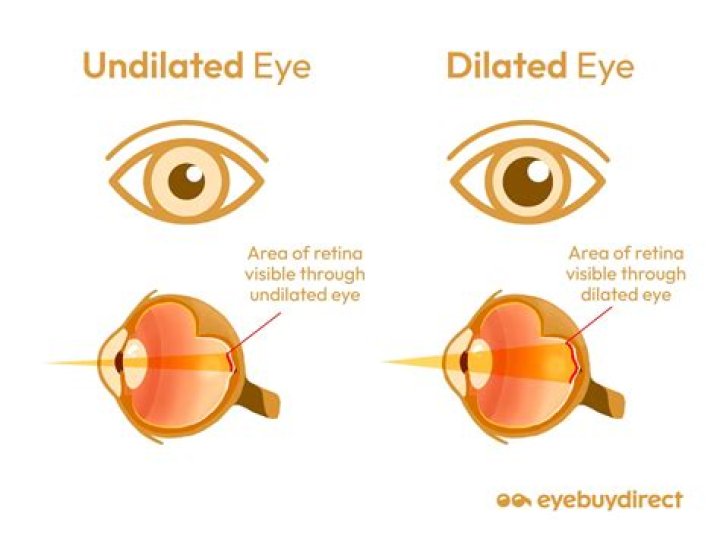 How eyes are dilated?