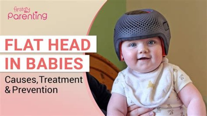 How flat head baby?