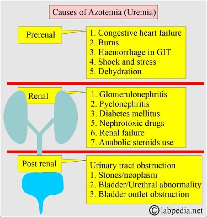 How is azotemia diagnosis?
