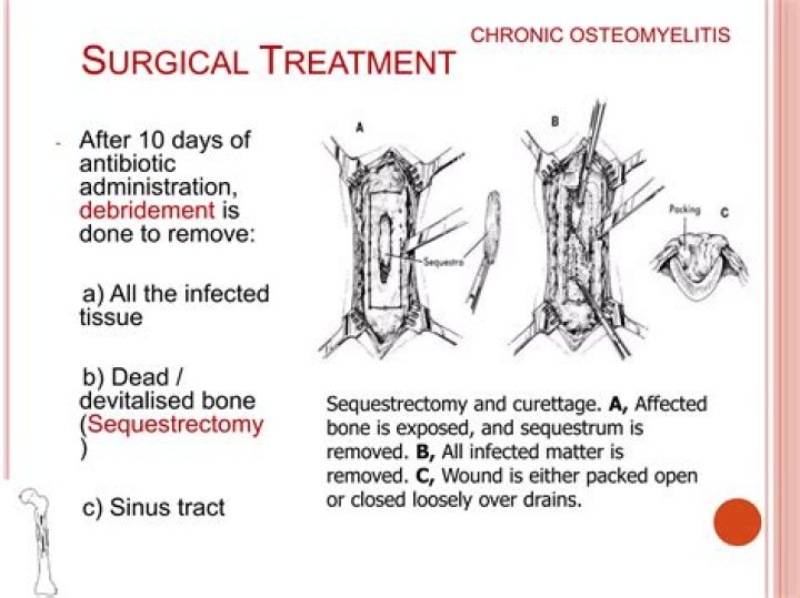 How is surgical removal of unwanted pregnancy misused?