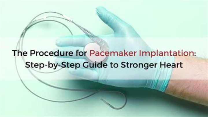 How pacemaker surgery is done?