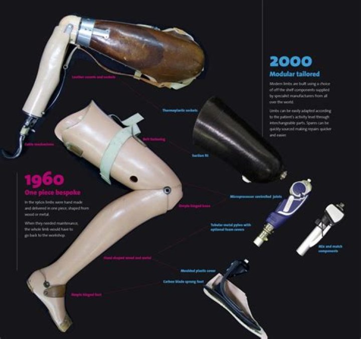How prosthetics changed lives?