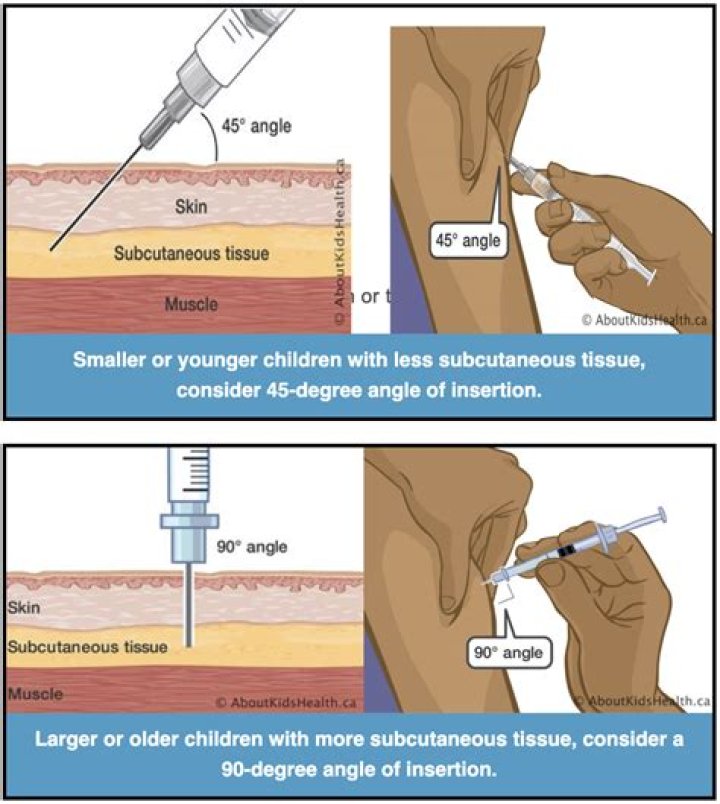 How to administer iron injection?