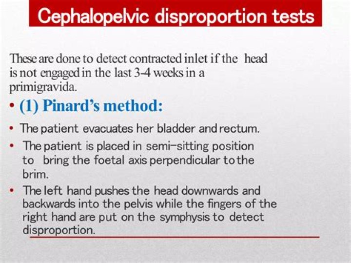 How to check cephalopelvic disproportion?