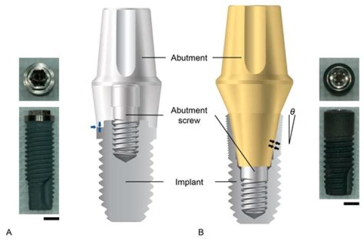 How to clean abutments?
