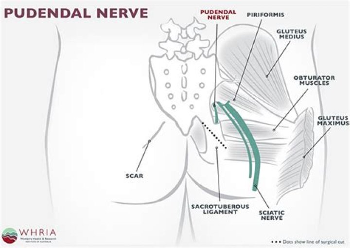 How to cure pudendal nerve?