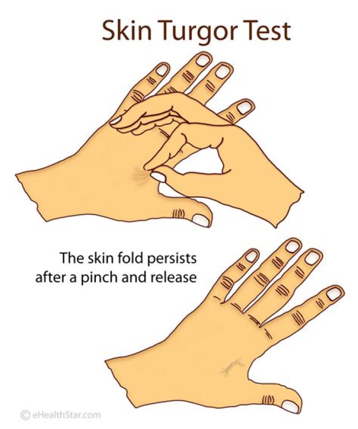 How to describe skin turgor?