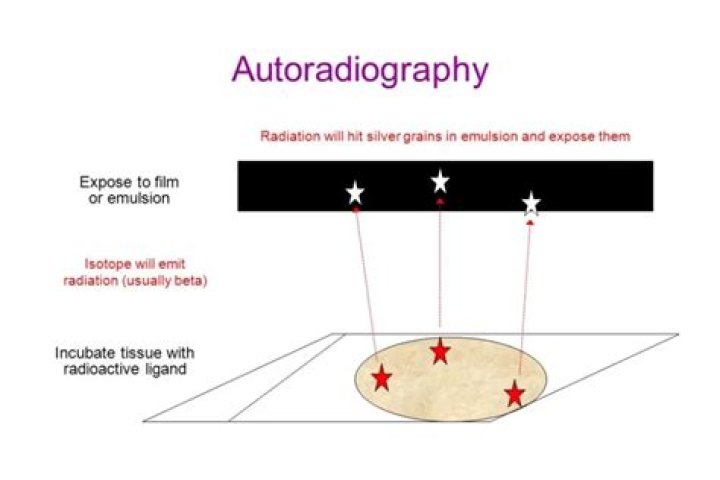 How to detect autoradiography?