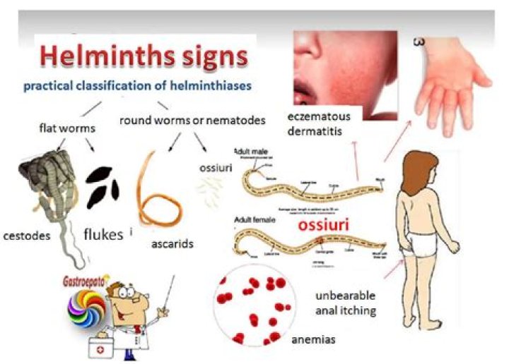 How to diagnose helminth infection?