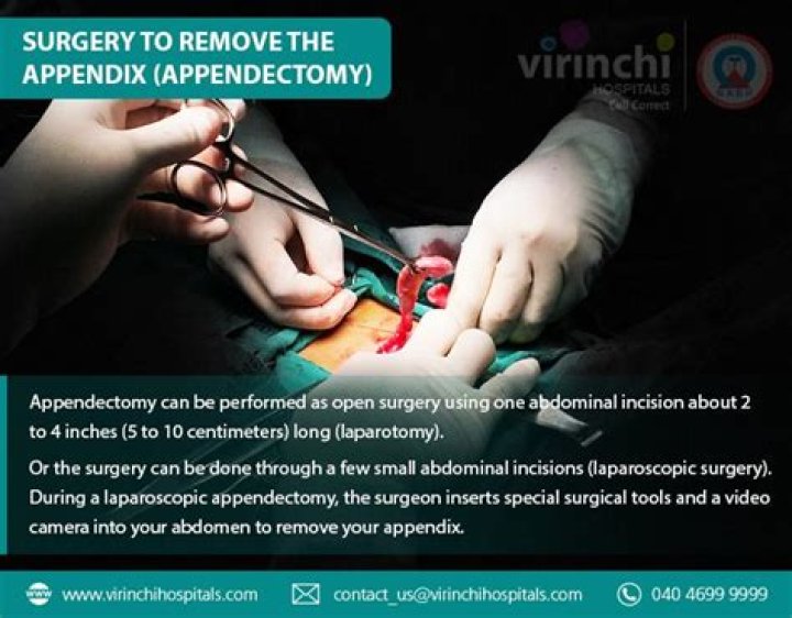 How to do appendectomy?