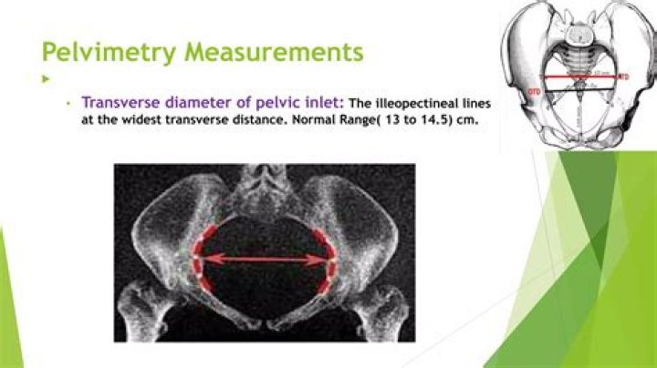 How to do clinical pelvimetry?