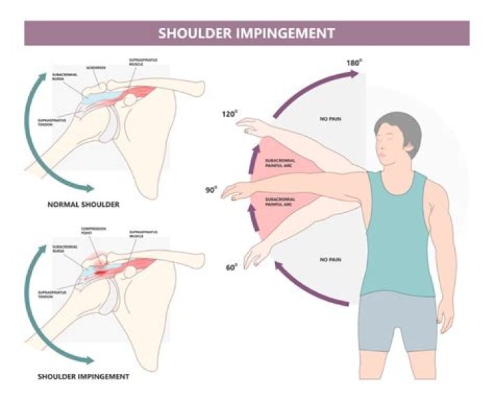 How to fix shoulder misalignment?