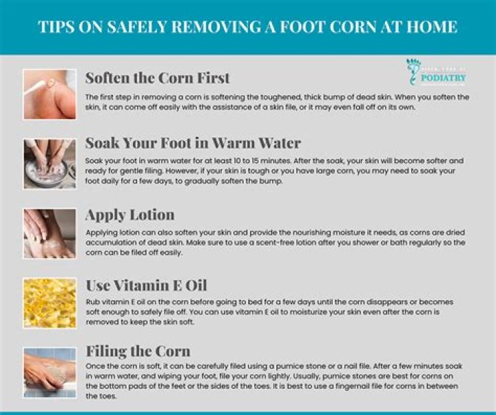 How to get rid of corns on feet?