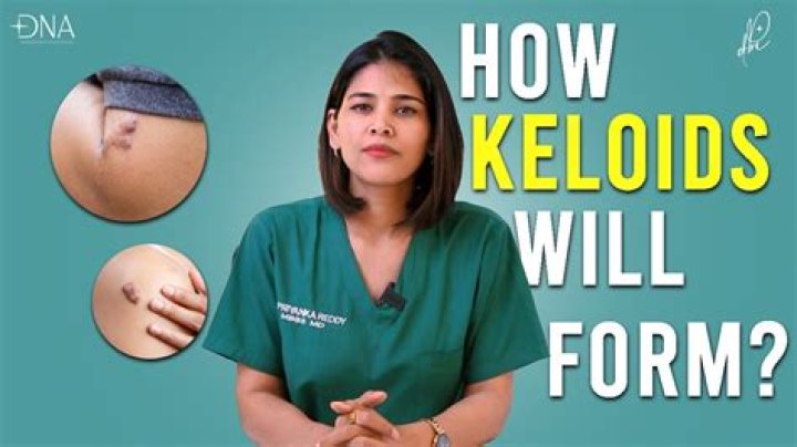 How to know if you're a keloid former?