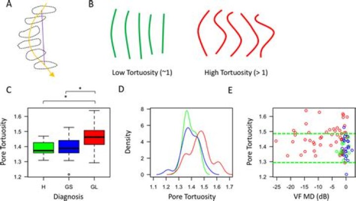 How to measure tortuosity?
