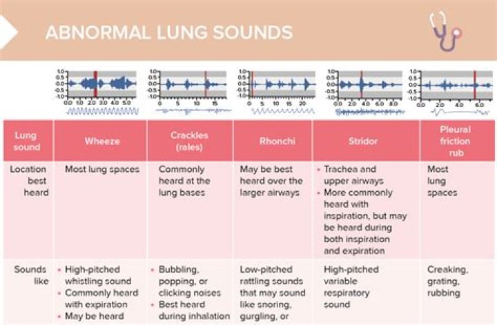 How to not sound congested?