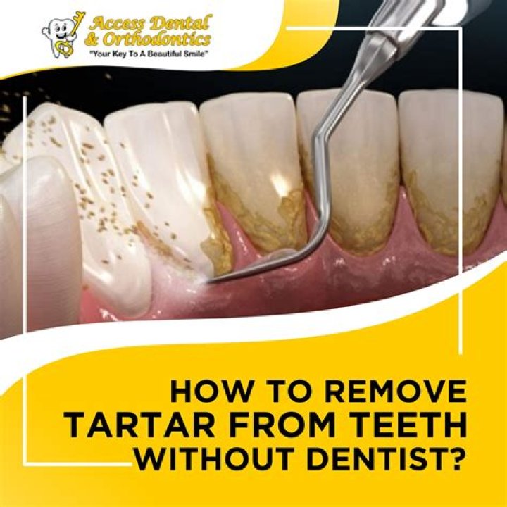 How to remove a teeth?