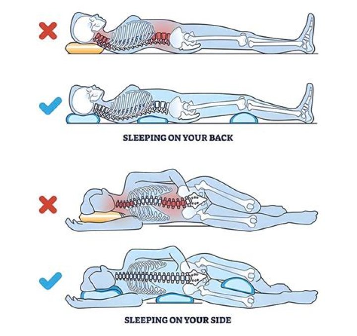 How to sleep with coccydynia?