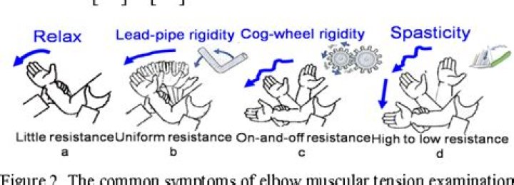 How to test for cogwheel rigidity?