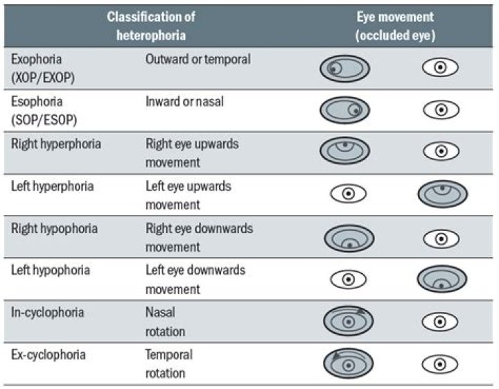 How to treat cyclophoria?