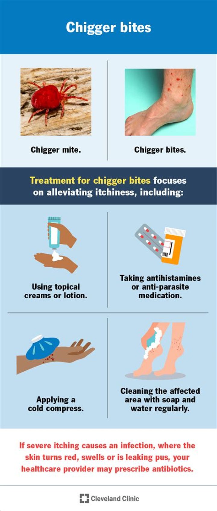 How to treat jiggers?