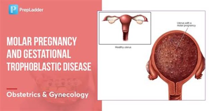 How to treat trophoblastic tumor?