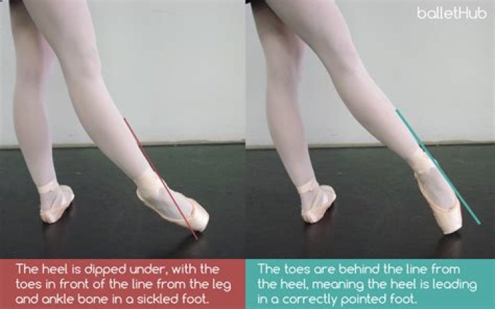 In dance what is a sickled foot?
