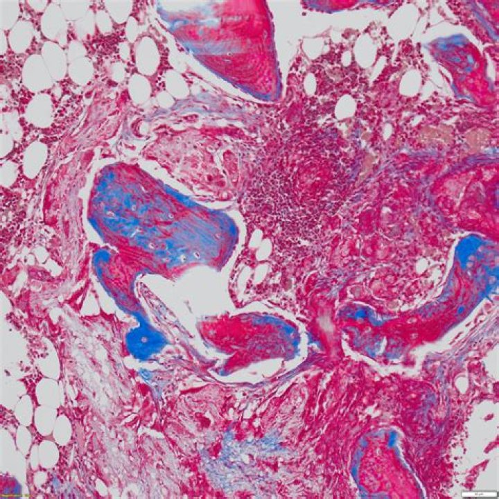 In masson trichrome stain?