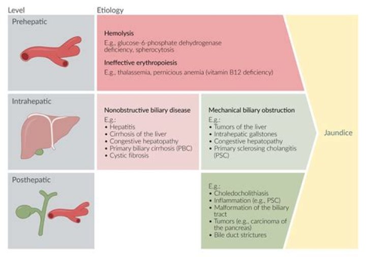 In post-hepatic jaundice why is urobilinogen decreased?