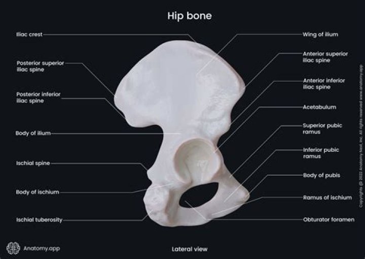 In the hip bone?