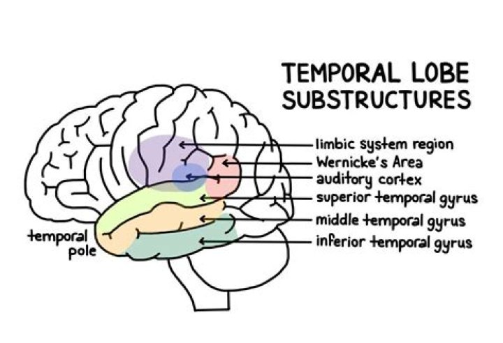 In the superior temporal gyrus?