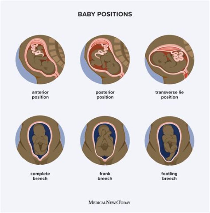 In the womb baby positions?
