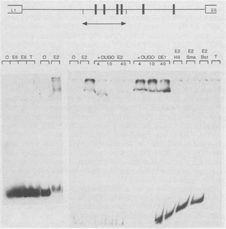 In vitro translation reticulocyte lysate?