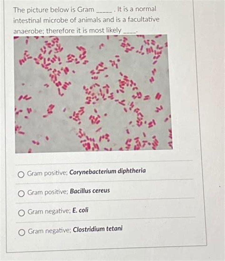 Is a facultative anaerobe?