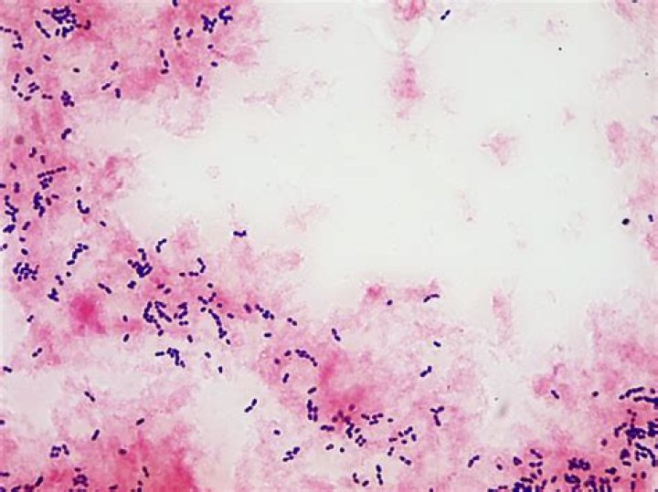 Is acinetobacter lwoffii contagious?