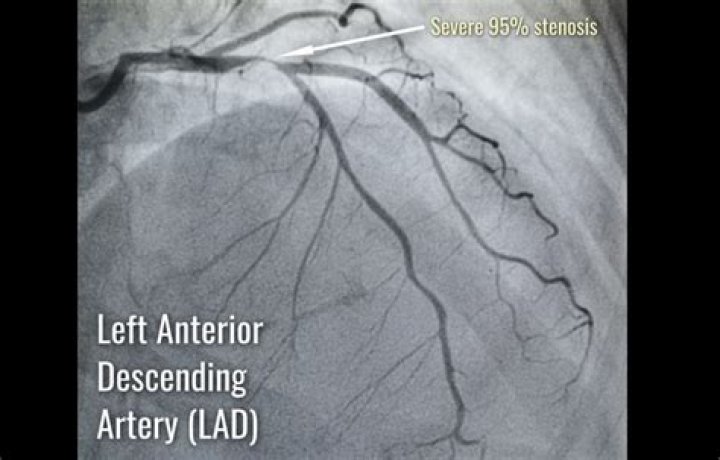 Is arteriography a word?