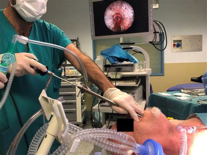Is bronchoscopy considered surgery?