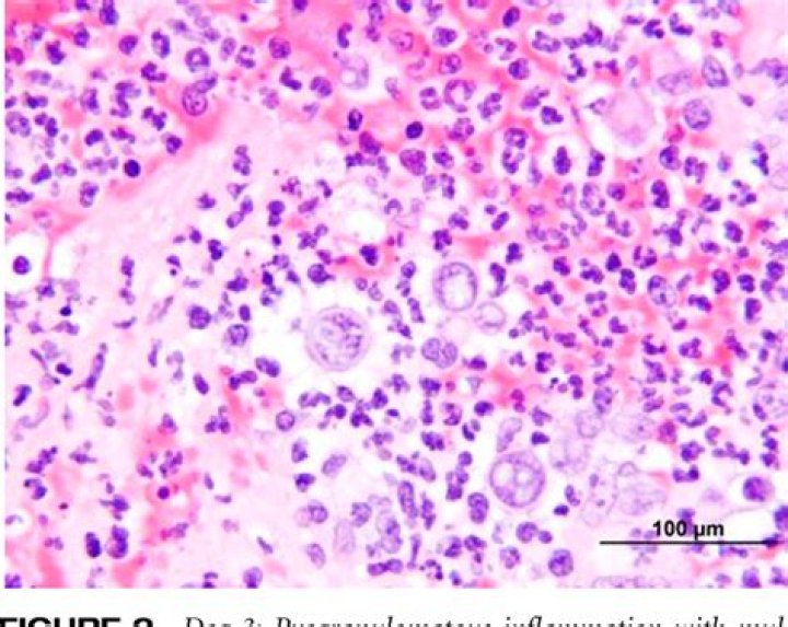 Is canine blastomycosis contagious?
