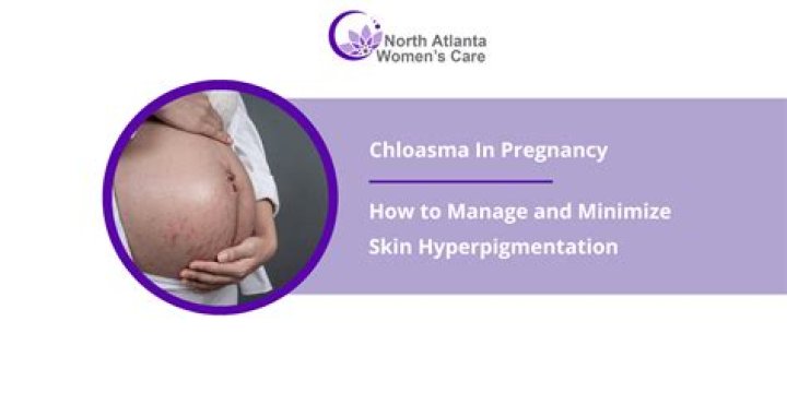 Is chloasma common in pregnancy?
