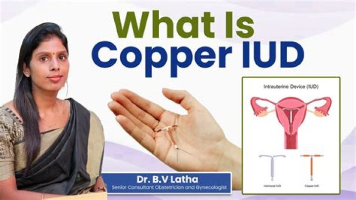 Is copper iud covered by ohip?