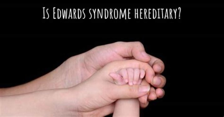 Is edwards syndrome hereditary?