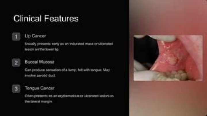 Is erythematous mucosa cancer?