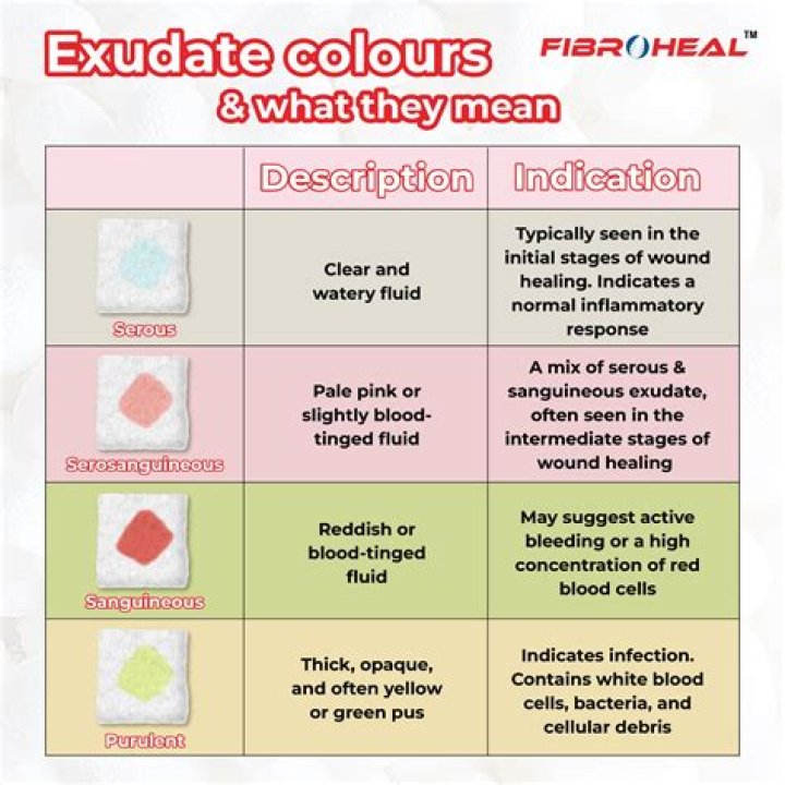 Is exudates a medical term?