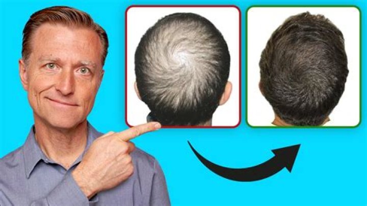 Is fallen hair regrow?