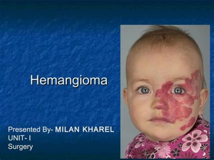 Is hemangiomas a medical condition?