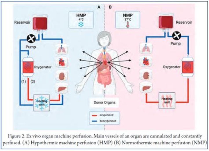 Is highly perfused organ?