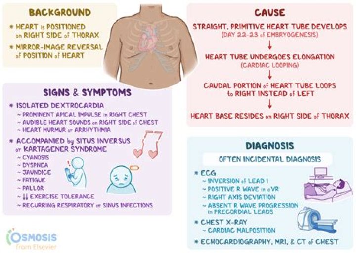 Is it normal to have dextrocardia?