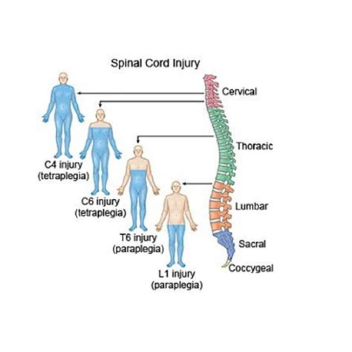 Is it possible to get un paralyzed?