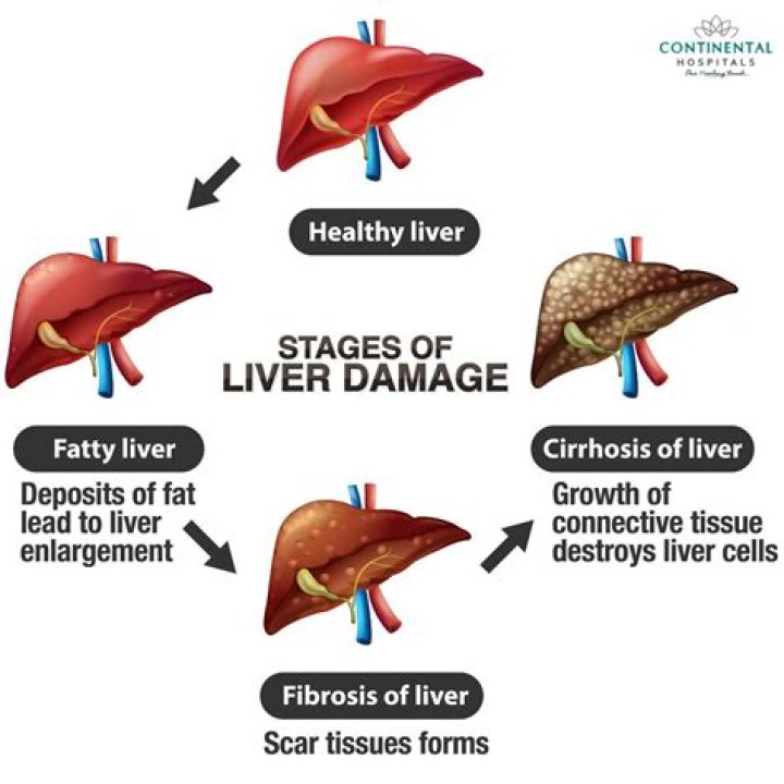 Is liver damage fatal?