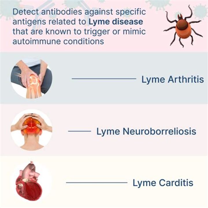 Is lyme disease carditis?